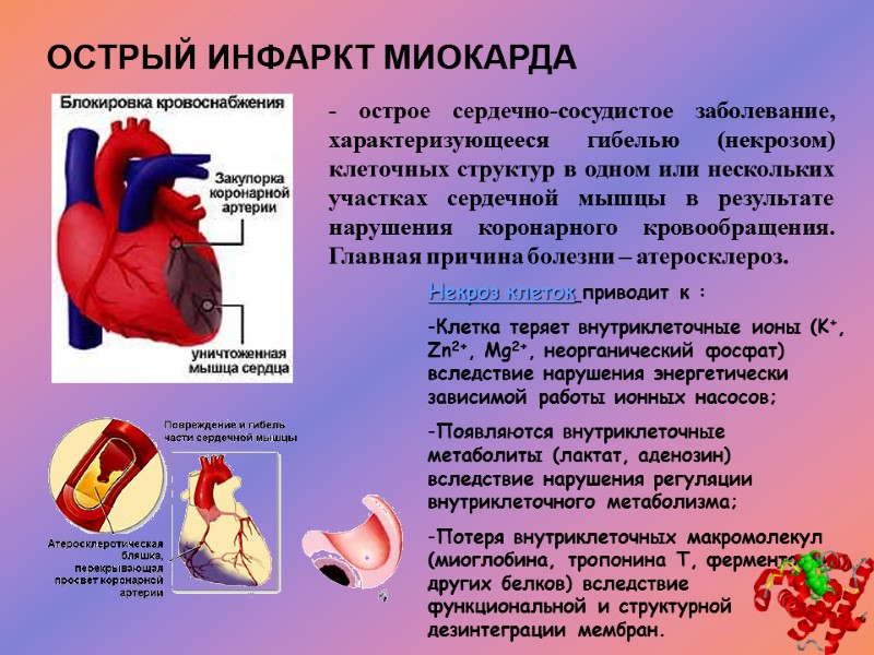 ОСТРЫЙ ИНФАРКТ МИОКАРДА - острое сердечно-сосудистое заболевание, характеризующееся гибелью (некрозом) клеточных структур в одном